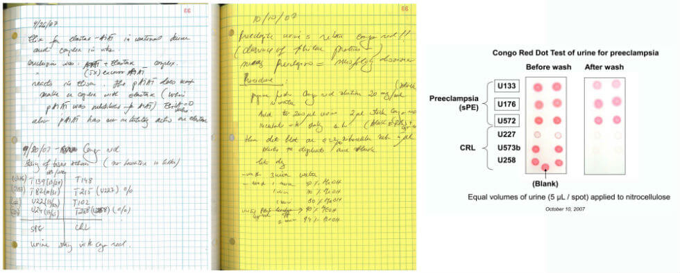 Image: Dr. Buhimschi’s notebook (at left) describing the testing method she invented to detect preeclampsia (at right).